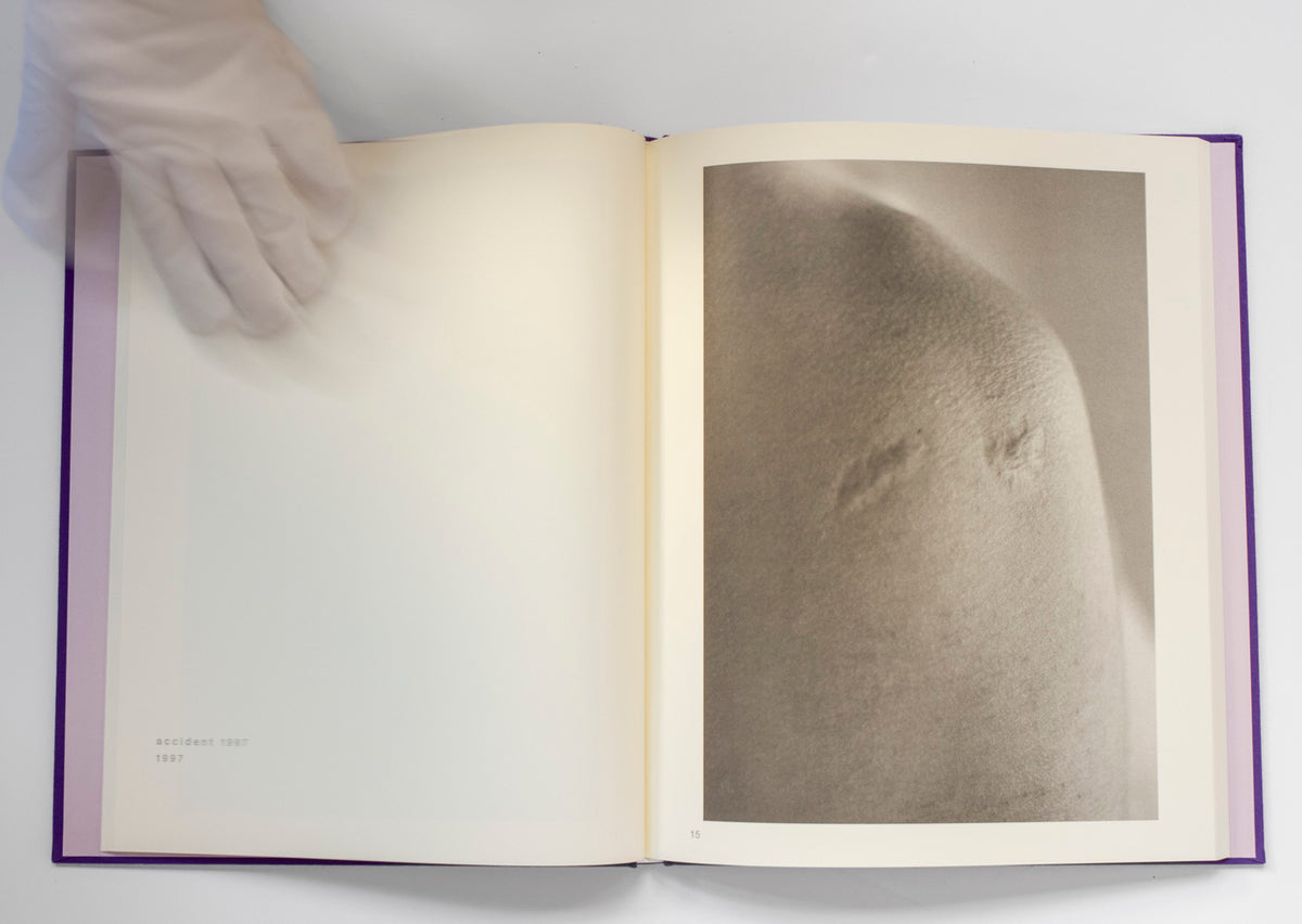 Scars *Signed
