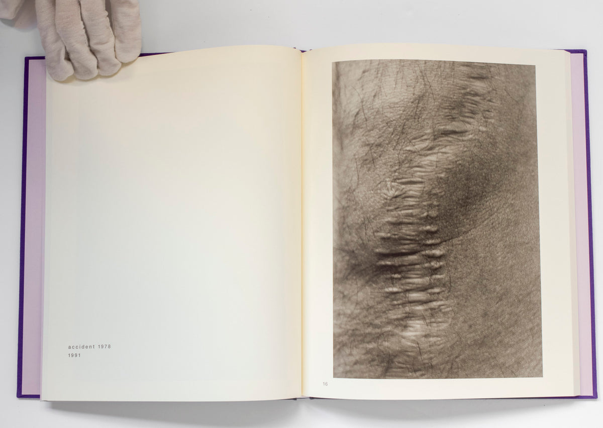 Scars *Signed