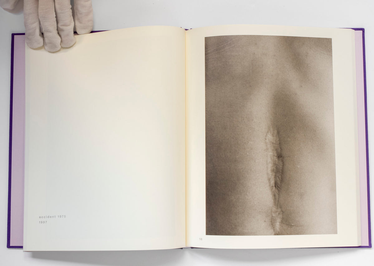 Scars *Signed