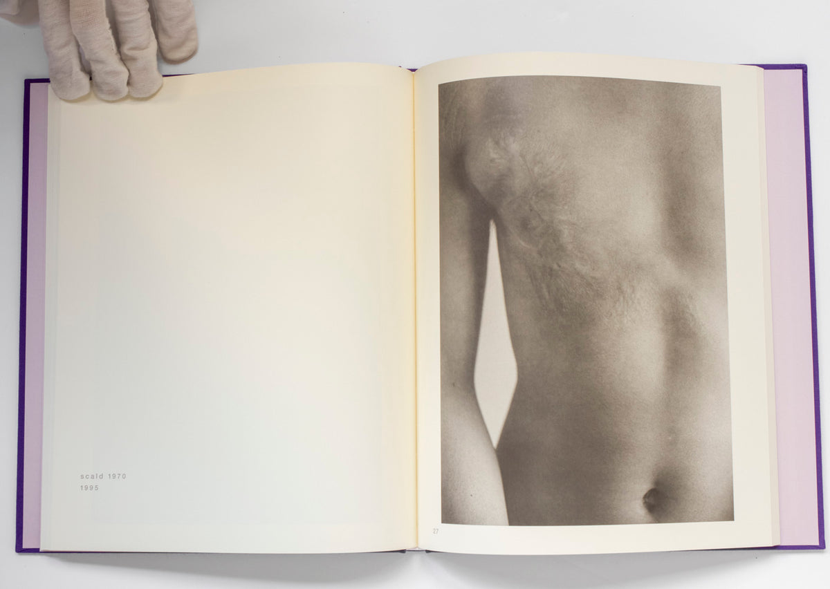 Scars *Signed